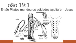 João 19:1
Então Pilatos mandou os soldados açoitarem Jesus
 