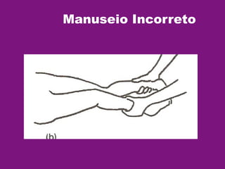 Manuseio Incorreto
 