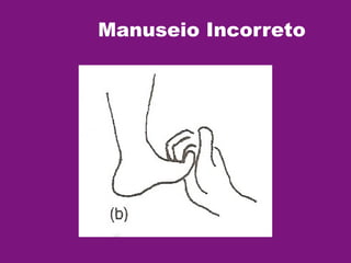 Manuseio Incorreto
 
