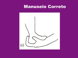 Manuseio Correto
 