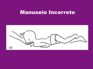Manuseio Incorreto
 