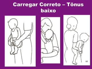 Carregar Correto – Tônus
baixo
 