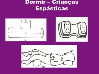 Dormir – Crianças
Espásticas
 