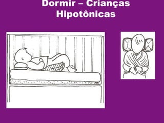 Dormir – Crianças
Hipotônicas
 