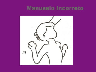 Manuseio Incorreto
 