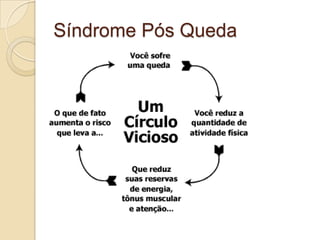 Síndrome Pós Queda
 