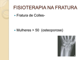 FISIOTERAPIA NA FRATURA
   Fratura de Colles-



   Mulheres > 50 (osteoporose)
 
