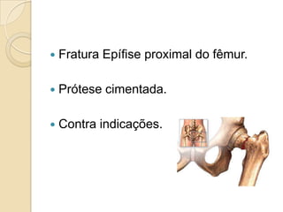    Fratura Epífise proximal do fêmur.

   Prótese cimentada.

   Contra indicações.
 