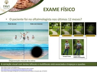 EXAME FÍSICO
https://www.univision.med.br/glaucoma/
https://www.jundeye.com.br/post/7-duvidas-frequentes-sobre-a-catarata
http://oftalmolog.com.br/especialidades/retina/degeneracao-macular/
https://www.researchgate.net/figure/A-normal-eye-and-eye-with-diabetic-retinopathy_fig1_337165932
Degeneração macular da retina
• O paciente foi no oftalmologista nos últimos 12 meses?
A correção visual com lentes bifocais e multifocais está associada a tropeços e quedas.
 