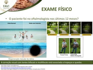 EXAME FÍSICO
https://www.univision.med.br/glaucoma/
https://www.jundeye.com.br/post/7-duvidas-frequentes-sobre-a-catarata
...