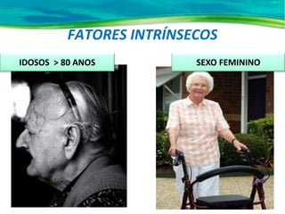 SEXO FEMININO
FATORES INTRÍNSECOS
IDOSOS > 80 ANOS
 