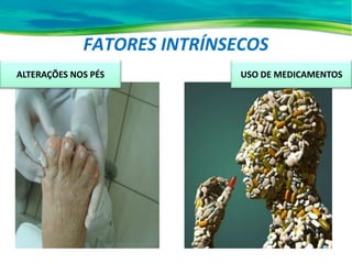 FATORES INTRÍNSECOS
ALTERAÇÕES NOS PÉS USO DE MEDICAMENTOS
 