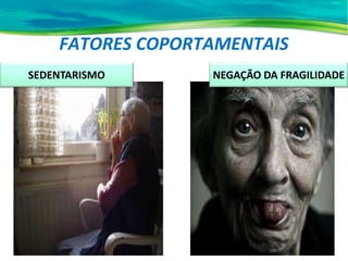 FATORES COPORTAMENTAIS
NEGAÇÃO DA FRAGILIDADE
SEDENTARISMO
 