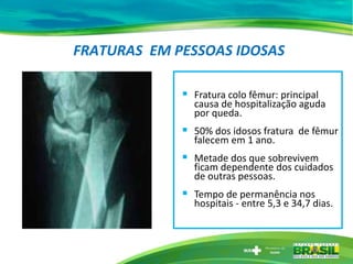 FRATURAS EM PESSOAS IDOSAS
 Fratura colo fêmur: principal
causa de hospitalização aguda
por queda.
 50% dos idosos fratura de fêmur
falecem em 1 ano.
 Metade dos que sobrevivem
ficam dependente dos cuidados
de outras pessoas.
 Tempo de permanência nos
hospitais - entre 5,3 e 34,7 dias.
 