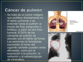 • Se trata de un tumor maligno 
que prolifera directamente en 
el tejido pulmonar o se 
extiende hasta el pulmón -a 
través del flujo sanguíneo o 
linfático- a partir de otro foco 
tumoral. El 83% de los 
cánceres de pulmón se 
asocian con el hábito de fumar. 
Las personas no fumadoras 
expuestas al humo del 
cigarrillo también pueden verse 
afectadas, como por la 
exposición a la polución, la 
radiación y al asbesto(grupo 
de minerales). 
 