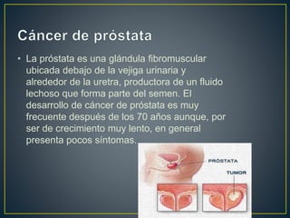 • La próstata es una glándula fibromuscular 
ubicada debajo de la vejiga urinaria y 
alrededor de la uretra, productora de un fluido 
lechoso que forma parte del semen. El 
desarrollo de cáncer de próstata es muy 
frecuente después de los 70 años aunque, por 
ser de crecimiento muy lento, en general 
presenta pocos síntomas. 
 