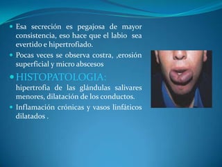 Queilitis | PPTX