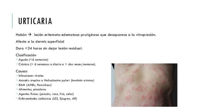 Queilitis Granulomatosa. Urticaria y Angioedema.