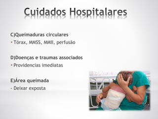 C)Queimaduras circulares
-Tórax, MMSS, MMII, perfusão
D)Doenças e traumas associados
-Providencias imediatas
E)Área queimada
- Deixar exposta
 