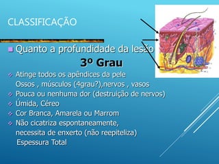  Quanto a profundidade da lesão
3º Grau
 Atinge todos os apêndices da pele
Ossos , músculos (4grau?),nervos , vasos
 Pouca ou nenhuma dor (destruição de nervos)
 Úmida, Céreo
 Cor Branca, Amarela ou Marrom
 Não cicatriza espontaneamente,
necessita de enxerto (não reepiteliza)
Espessura Total
CLASSIFICAÇÃO
 