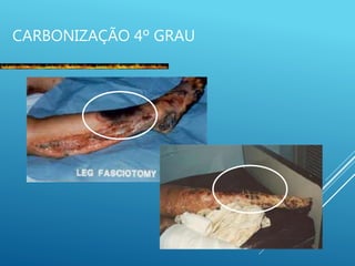 CARBONIZAÇÃO 4º GRAU
 