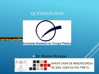 QUEIMADURAS
Dr. Brunno Rosique
 