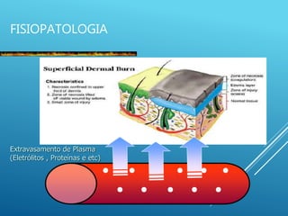FISIOPATOLOGIA
Extravasamento de Plasma
(Eletrólitos , Proteínas e etc)
 