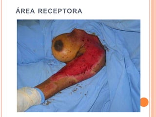 ÁREA RECEPTORA
 