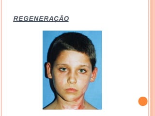 REGENERAÇÃO
 