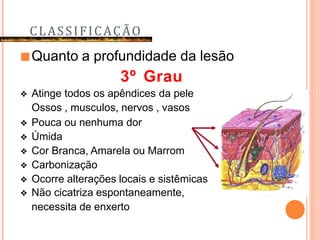 CLASSIFICAÇÃO
■Quanto a profundidade da lesão
3º Grau
❖ Atinge todos os apêndices da pele
Ossos , musculos, nervos , vasos
❖ Pouca ou nenhuma dor
❖ Úmida
❖ Cor Branca, Amarela ou Marrom
❖ Carbonização
❖ Ocorre alterações locais e sistêmicas
❖ Não cicatriza espontaneamente,
necessita de enxerto
 