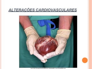 ALTERAÇÕES CARDIOVASCULARES
 