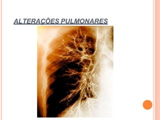 ALTERAÇÕES PULMONARES
 