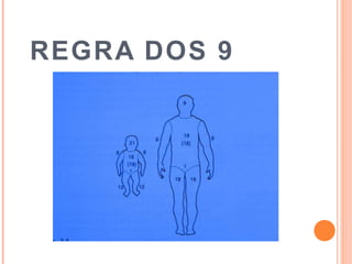 REGRA DOS 9
 