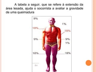 A tabela a seguir, que se refere à extensão da
área lesada, ajuda o socorrista a avaliar a gravidade
de uma queimadura
 