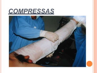 COMPRESSAS
 