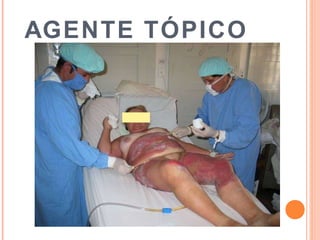 AGENTE TÓPICO
 