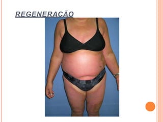 REGENERAÇÃO
 