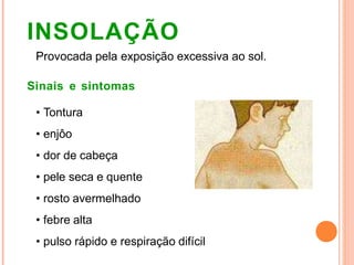 INSOLAÇÃO
Provocada pela exposição excessiva ao sol.
Sinais e sintomas
• Tontura
• enjôo
• dor de cabeça
• pele seca e quente
• rosto avermelhado
• febre alta
• pulso rápido e respiração difícil
 