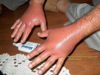 No final do dia eu tive que cortar a minha aliança. 