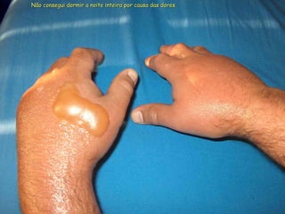 Não consegui dormir a noite inteira por causa das dores. 