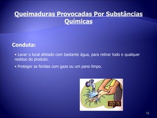 Queimaduras Provocadas Por Substâncias Químicas Conduta: Lavar o local afetado com bastante água, para retirar todo e qualquer resíduo do produto. Proteger as feridas com gaze ou um pano limpo. 