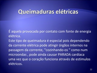 É aquela provocada por contato com fonte de energia elétrica.  Este tipo de queimadura é especial pois dependendo da corrente elétrica pode atingir órgãos internos na passagem da corrente, "cozinhando-os " como num microondas , pode ainda causar PARADA cardíaca uma vez que o coração funciona através de estímulos elétricos. 