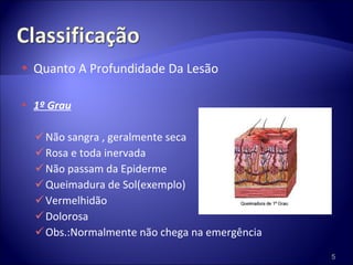 Quanto A Profundidade Da Lesão 1º Grau Não sangra , geralmente seca Rosa e toda inervada Não passam da Epiderme Queimadura de Sol(exemplo) Vermelhidão Dolorosa Obs.:Normalmente não chega na emergência 