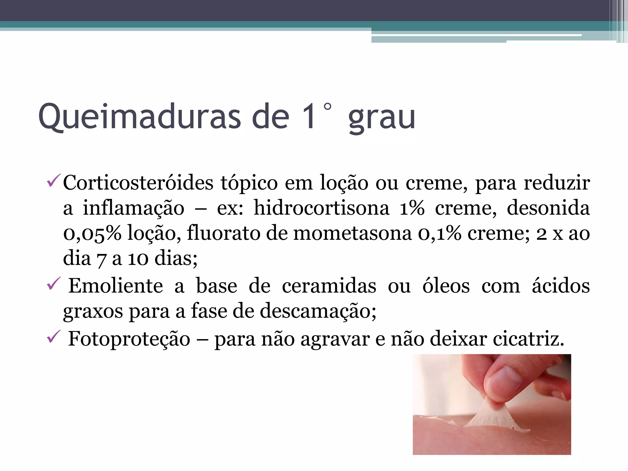 Queimaduras de 1° grau
Corticosteróides tópico em loção ou creme, para reduzir
a inflamação – ex: hidrocortisona 1% creme, desonida
0,05% loção, fluorato de mometasona 0,1% creme; 2 x ao
dia 7 a 10 dias;
 Emoliente a base de ceramidas ou óleos com ácidos
graxos para a fase de descamação;
 Fotoproteção – para não agravar e não deixar cicatriz.
 