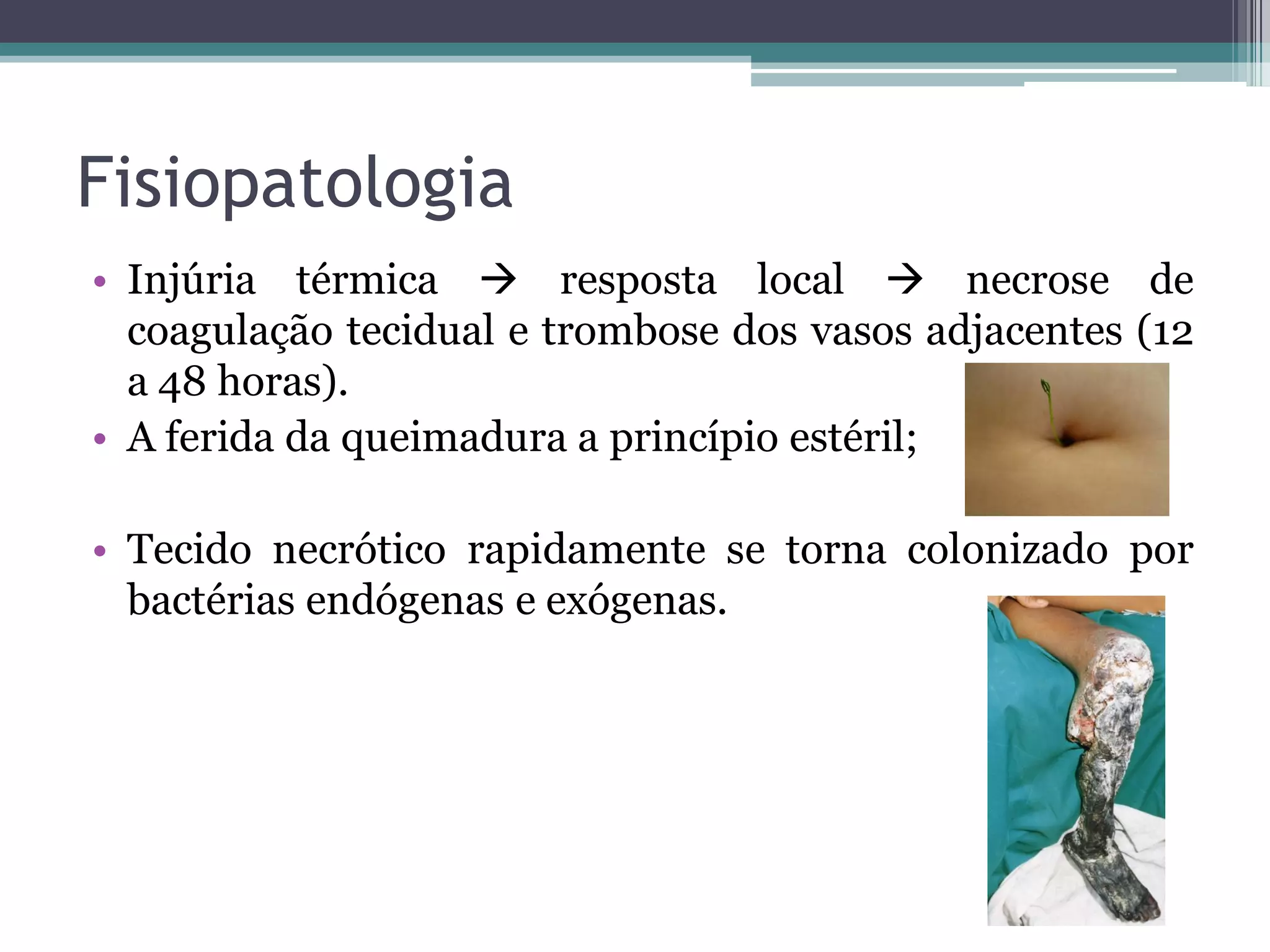 Fisiopatologia
• Injúria térmica  resposta local  necrose de
coagulação tecidual e trombose dos vasos adjacentes (12
a 48 horas).
• A ferida da queimadura a princípio estéril;
• Tecido necrótico rapidamente se torna colonizado por
bactérias endógenas e exógenas.
 