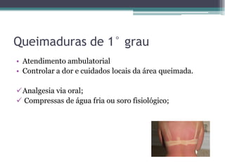 Queimaduras de 1° grau
• Atendimento ambulatorial
• Controlar a dor e cuidados locais da área queimada.
Analgesia via oral;
 Compressas de água fria ou soro fisiológico;
 