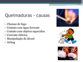 Queimaduras - causas
• Chamas de fogo
• Contato com água fervente
• Contato com objetos aquecidos
• Corrente elétrica
• Manipulação do álcool
• Airbag
 