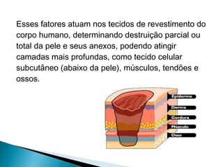 Esses fatores atuam nos tecidos de revestimento do
corpo humano, determinando destruição parcial ou
total da pele e seus anexos, podendo atingir
camadas mais profundas, como tecido celular
subcutâneo (abaixo da pele), músculos, tendões e
ossos.
 