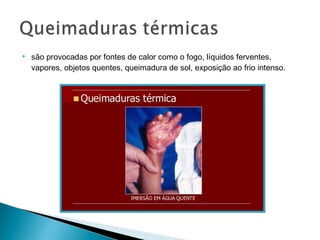  são provocadas por fontes de calor como o fogo, líquidos ferventes,
vapores, objetos quentes, queimadura de sol, exposição ao frio intenso.
 