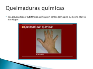  são provocadas por substâncias químicas em contato com a pele ou mesmo através
das roupas
 
